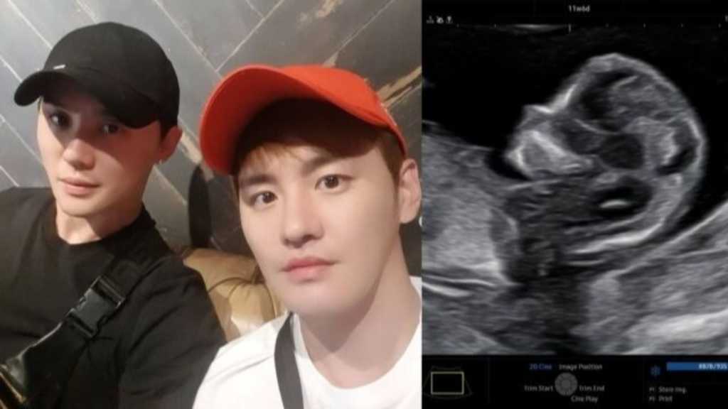 “ジュンスの双子の兄”キム・ムヨン、妻の第3子妊娠を発表「奇跡が訪れた」