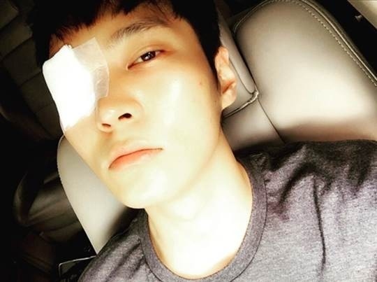 チュウォン ものもらいができて悲しそうな表情 ストレスのせいで Kstyle