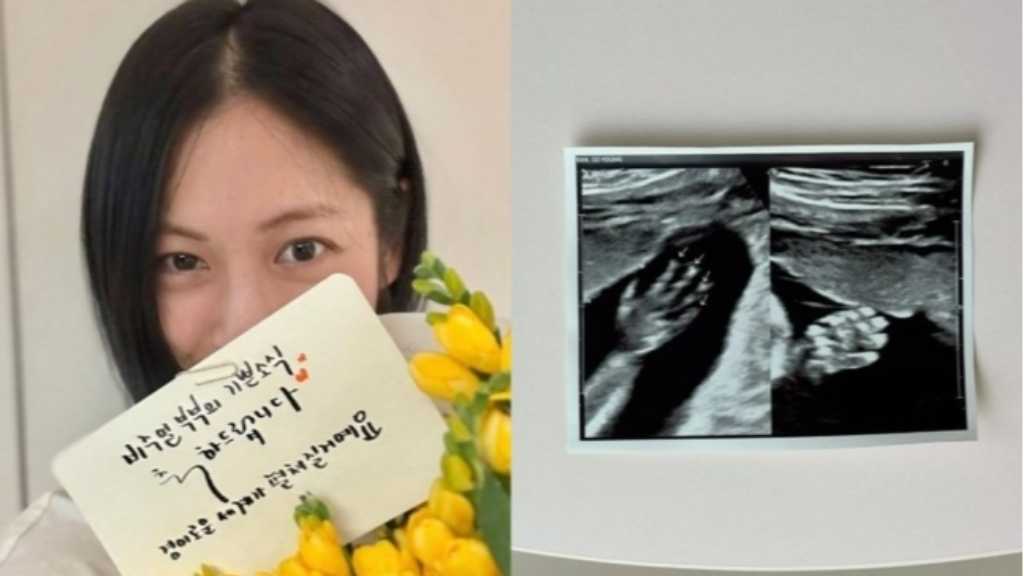 女優パン・ソヨン、結婚から4年…第1子の妊娠報告に祝福の声