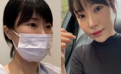 イ・セヨン、二重まぶたを再整形…手術過程も公開「本当に痛かった」（動画あり）