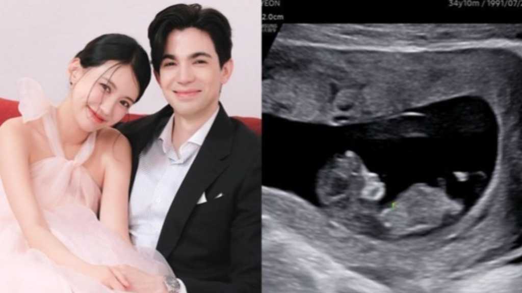 元LPG キム・ソヨン&ロビン夫婦、流産を乗り越えて妊娠発表…胎児ネームも明かす