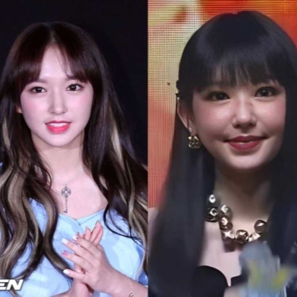 宇宙少女 ソンソ、激変したビジュアルに心配の声…「薬の副作用」と報道