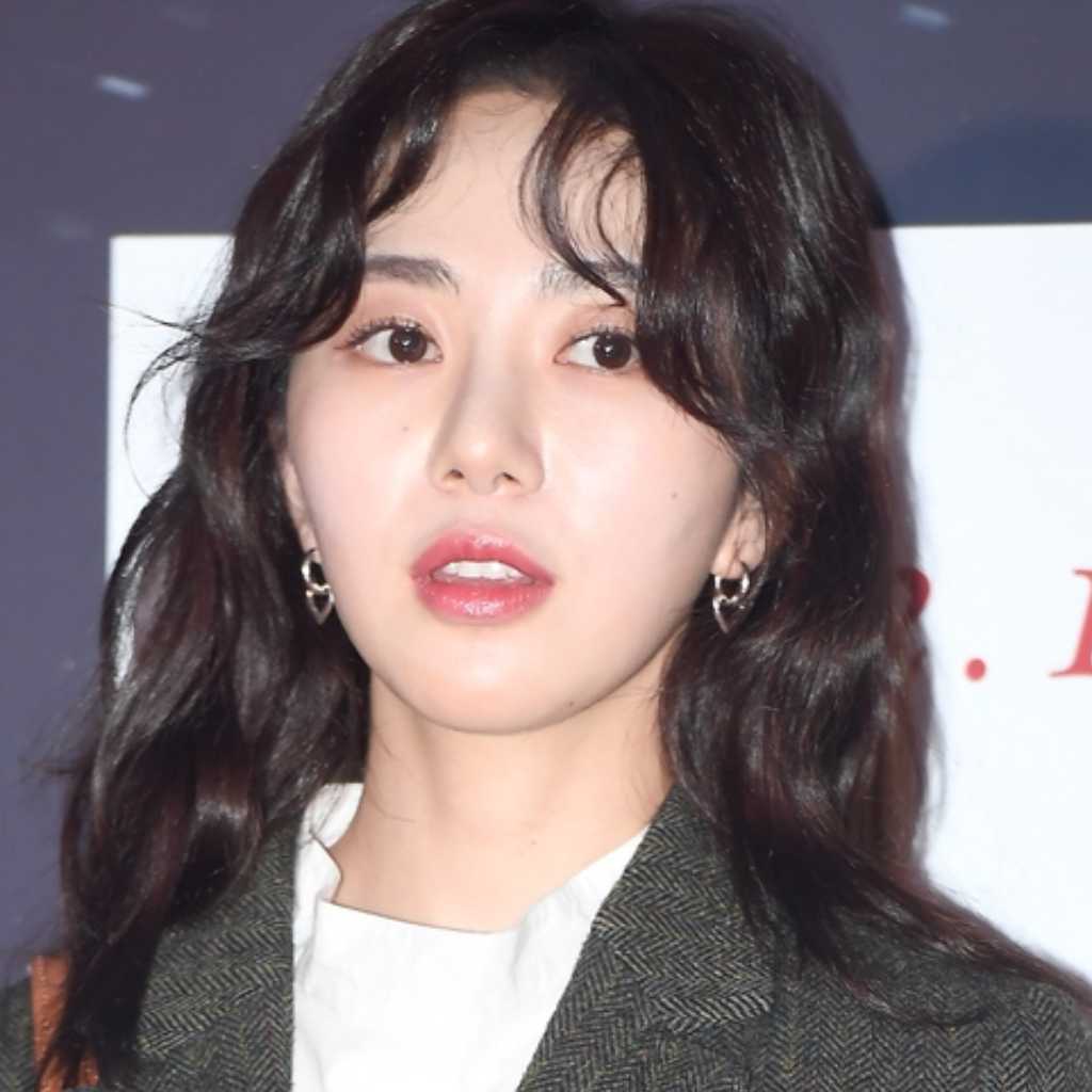 AOA出身ミナ、美容施術によるやけど被害に辛い心境を吐露「正気を失った…犯した罪が多すぎたのか」